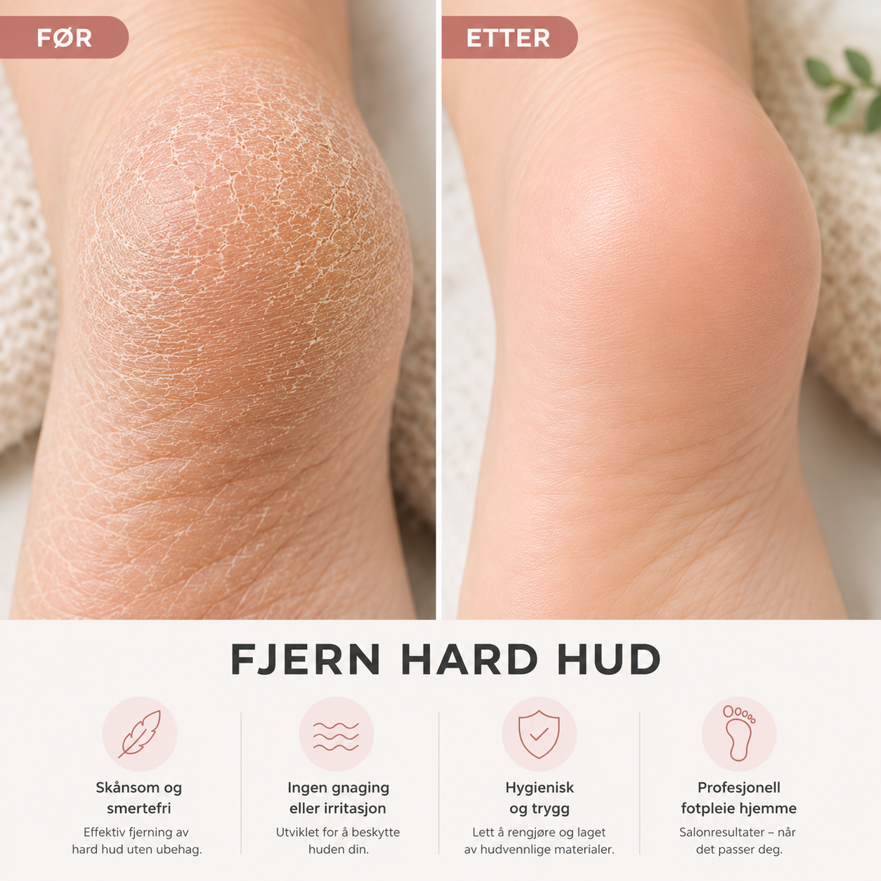 Hilma Nordic™ – Salonmyke føtter på minutter